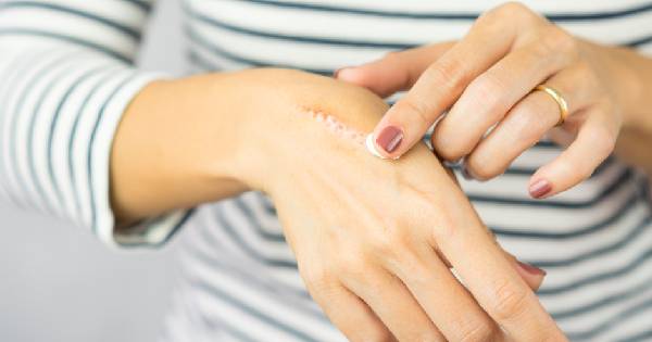 The Power of Ayurveda for Wound Healing