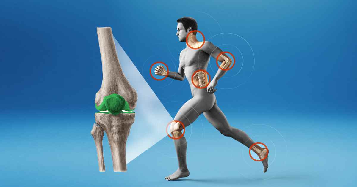 What you should know before taking joint health supplements