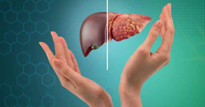 Life's Filter: How the Liver Protects and Purifies Our Body