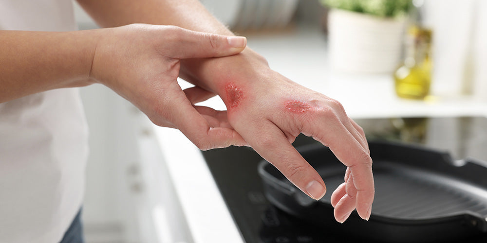 Ayurvedic Medicine for Healing Wounds